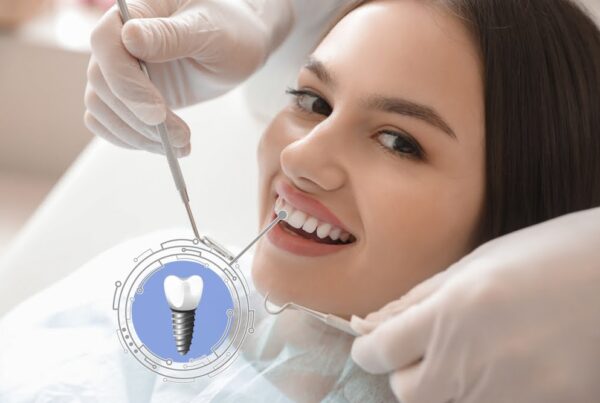 Dental Implants vs. Veneers