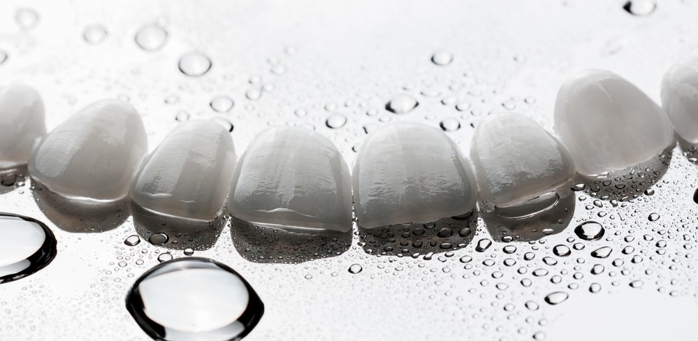 What Is Dental Veneer And How Is It Done?