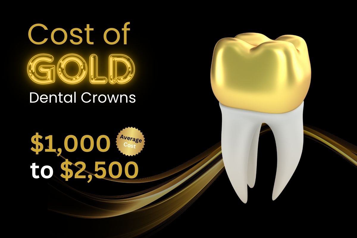 Cost of Gold Dental Crowns
