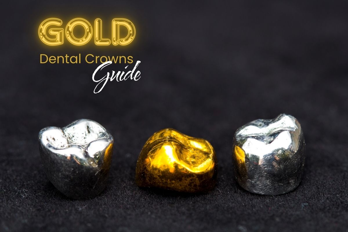 Gold Dental Crowns Guide