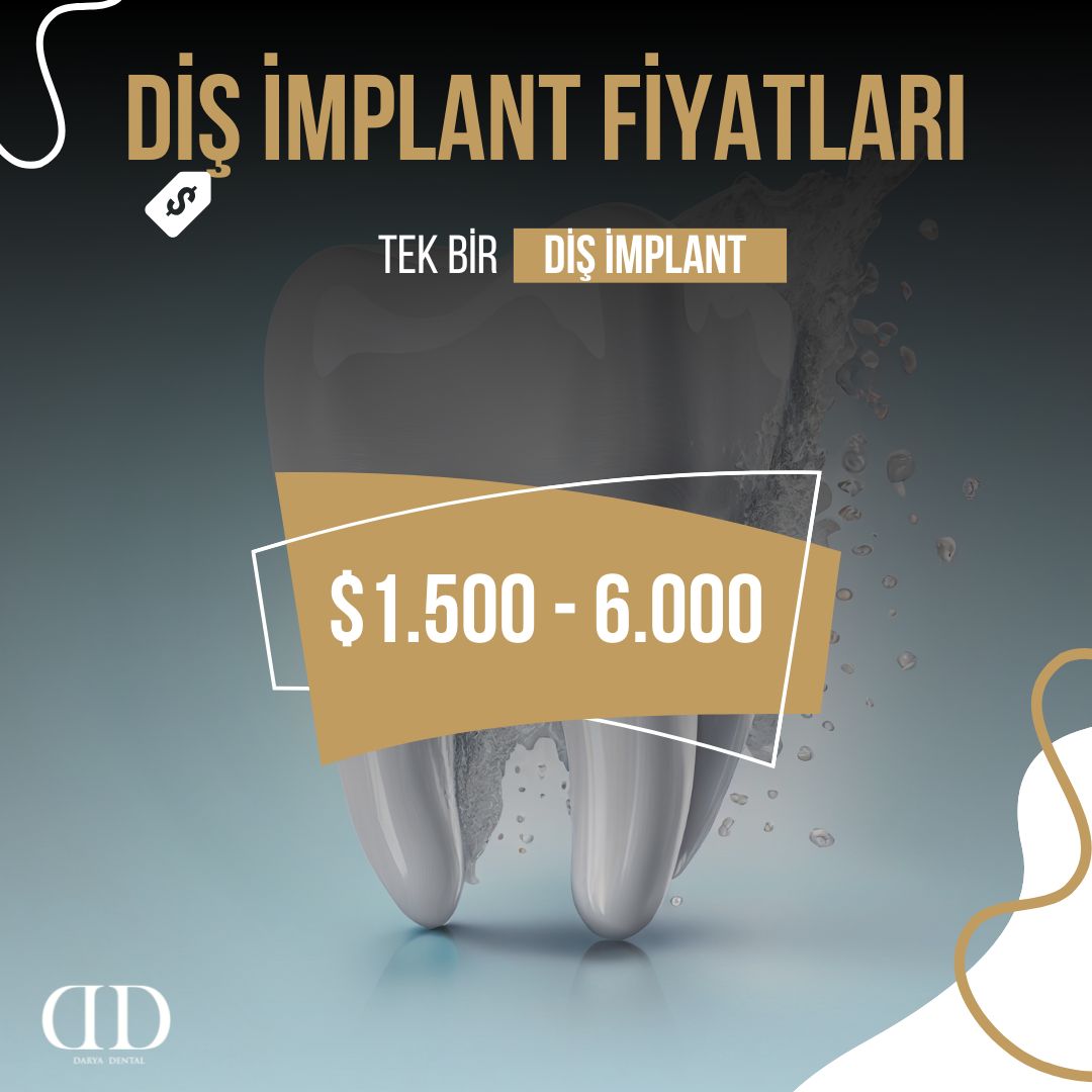 Diş İmplant Fiyatları