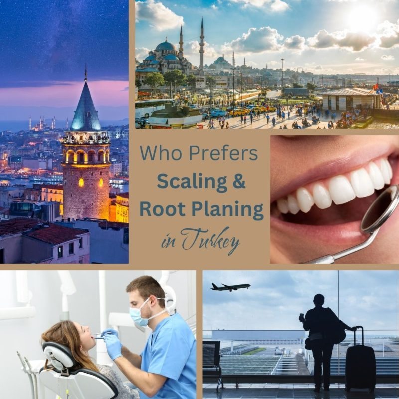 Who prefers scaling & root planning in Turkey