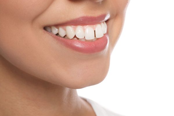 Buck Teeth Causes and Treatments in Turkey