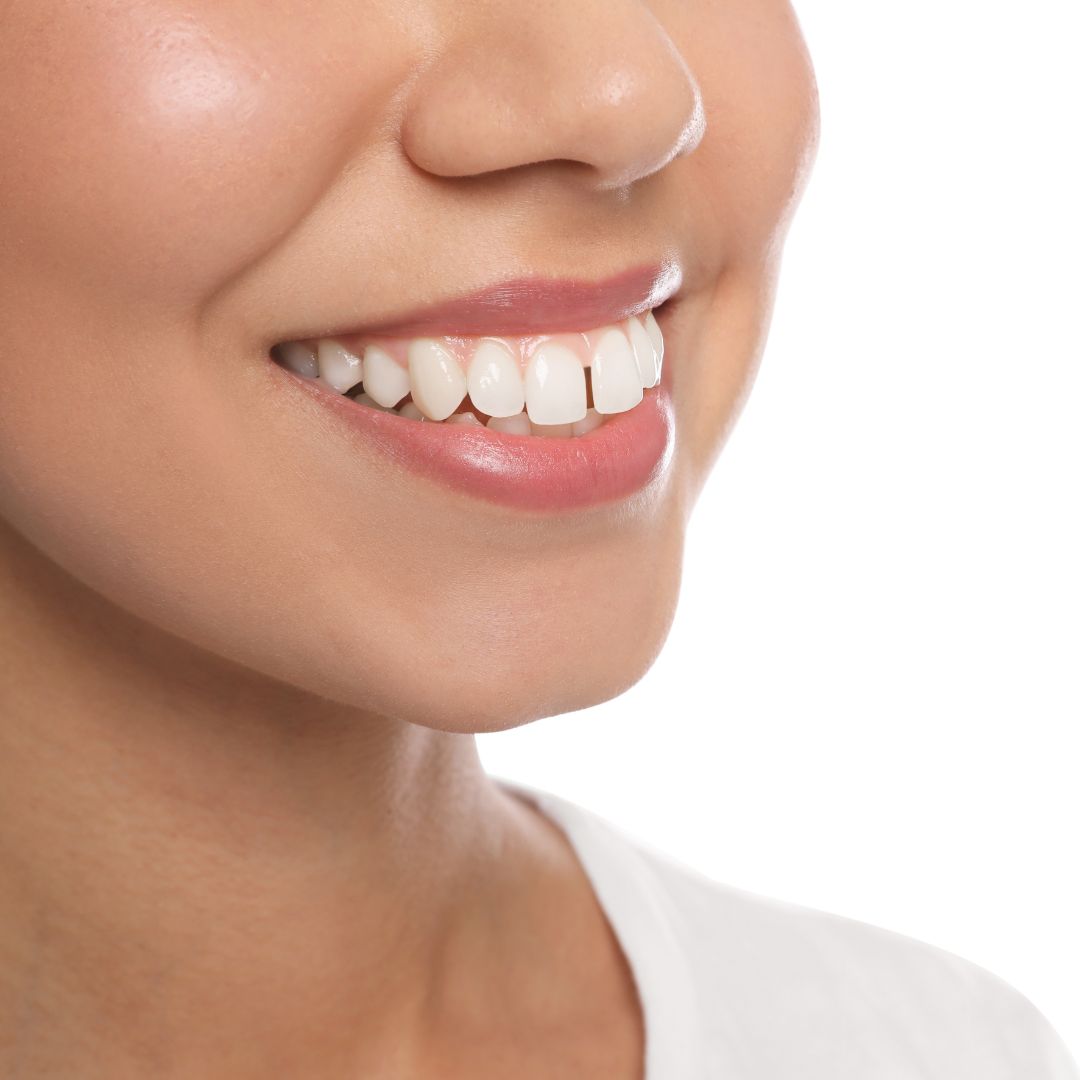 Buck Teeth Causes and Solutions in Turkey