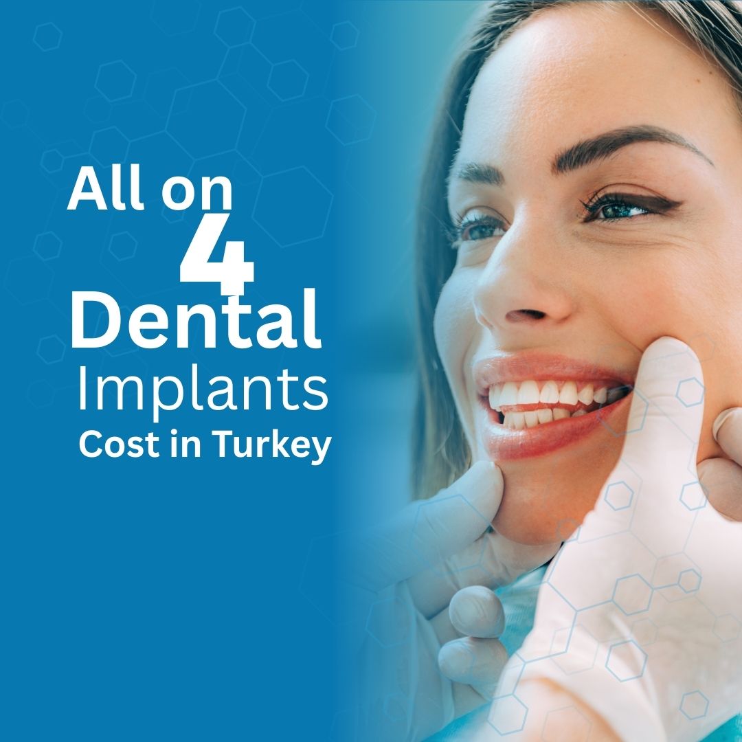 All on four implants cost in Turkey