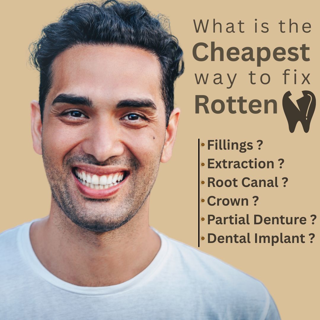 Cheapest Way to Fix Rotten Teeth