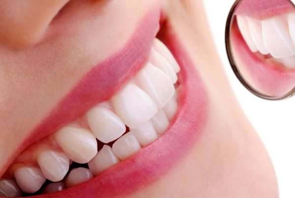 doğal diş beyazlatma