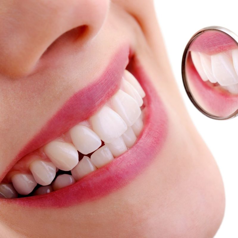 doğal diş beyazlatma