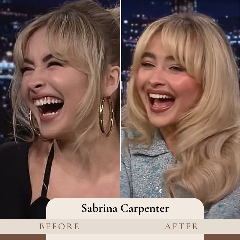 Sabrina Carpenter Teeth Before and After
