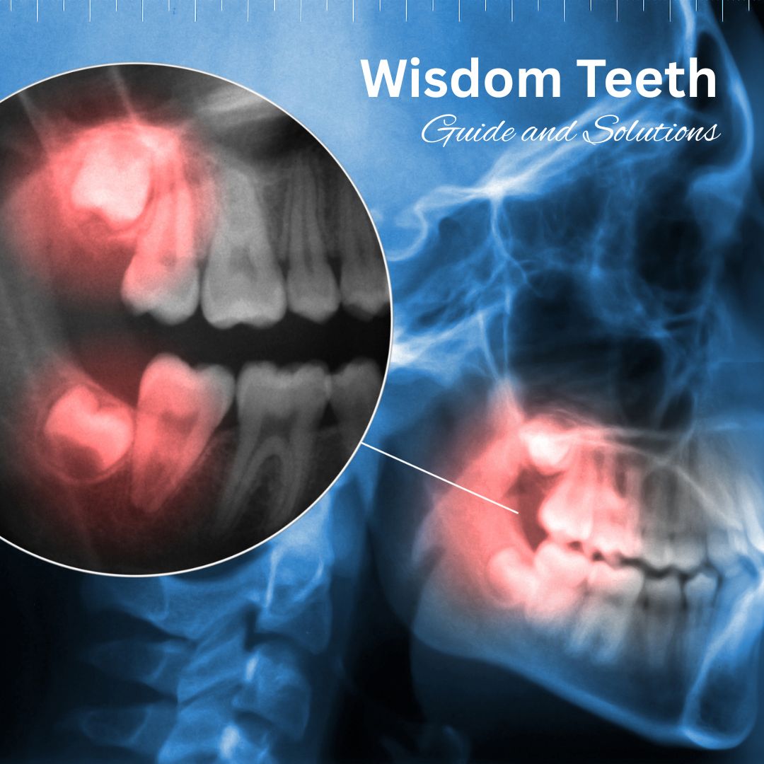 Wisdom Teeth Guide and Solutions in Turkey