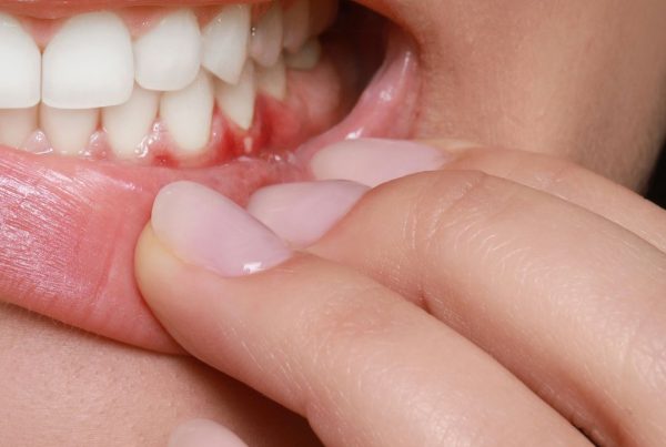 Dental abscess causes treatments
