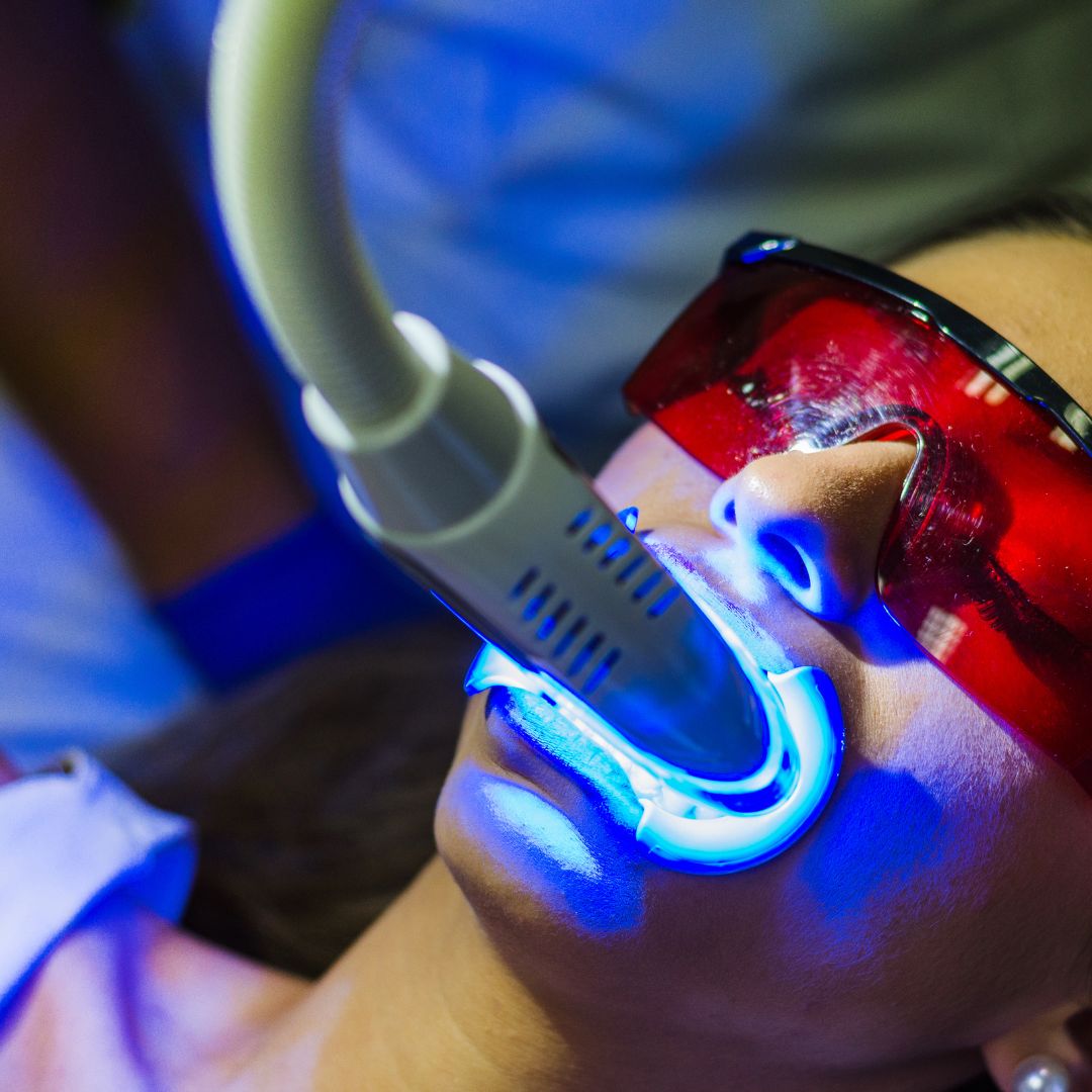 diş beyazlatma yöntemleri ümraniye