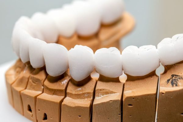 lamine ve zirkonyum arasındaki fark