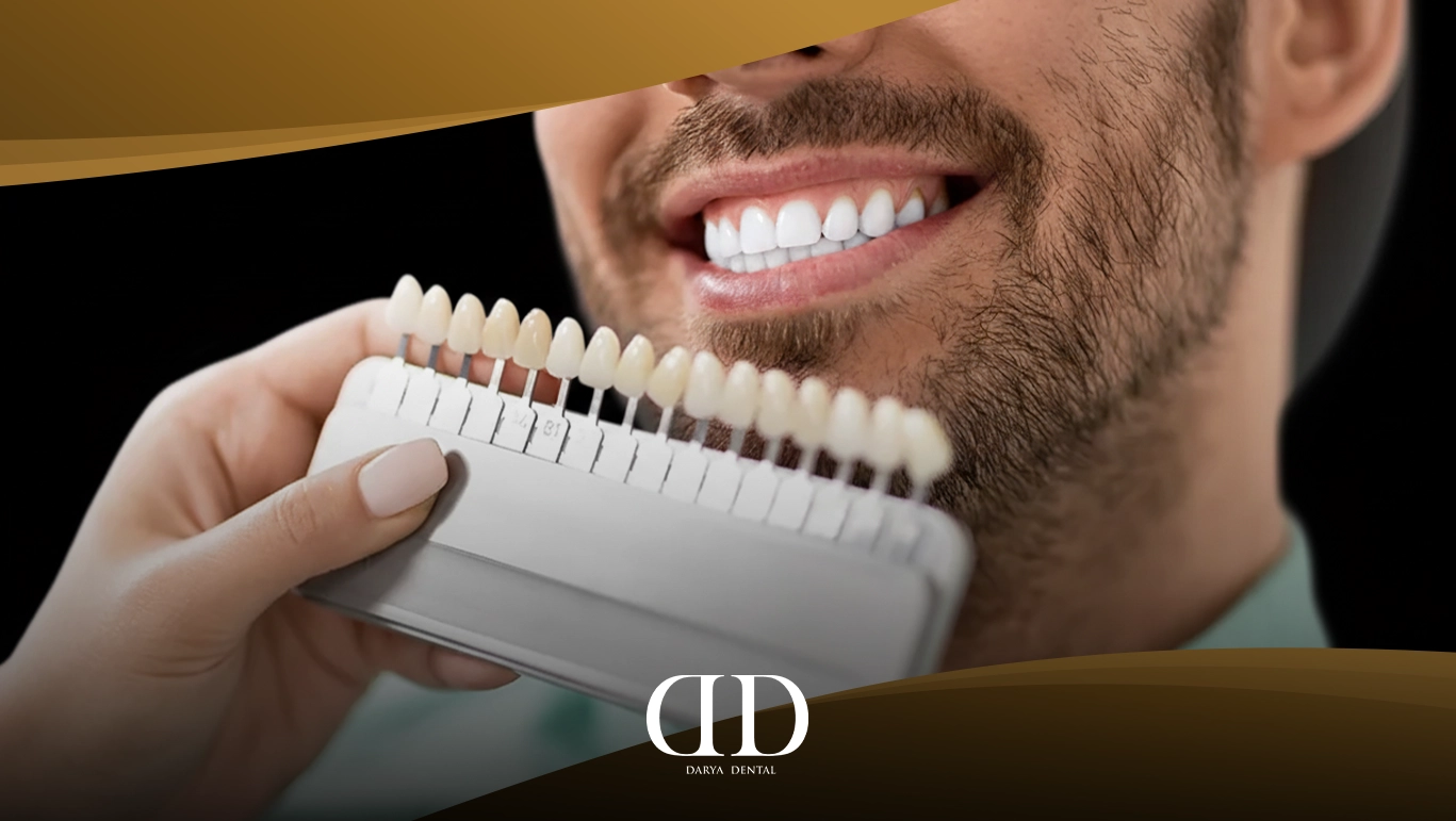 Things To Know About Emax Dental Veneer