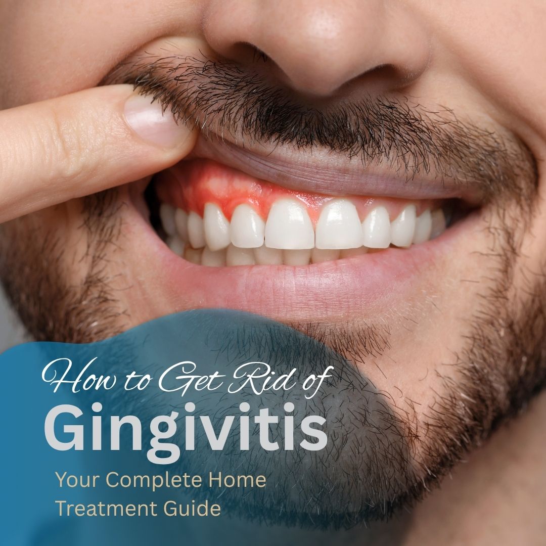 How to Get Rid of Gingivitis