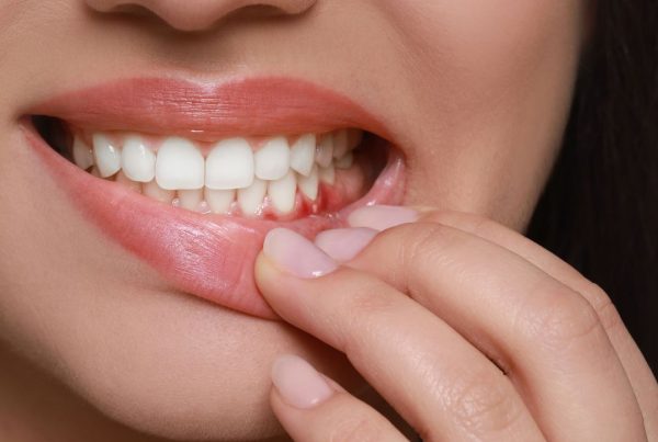 how to get rid of Gingivitis