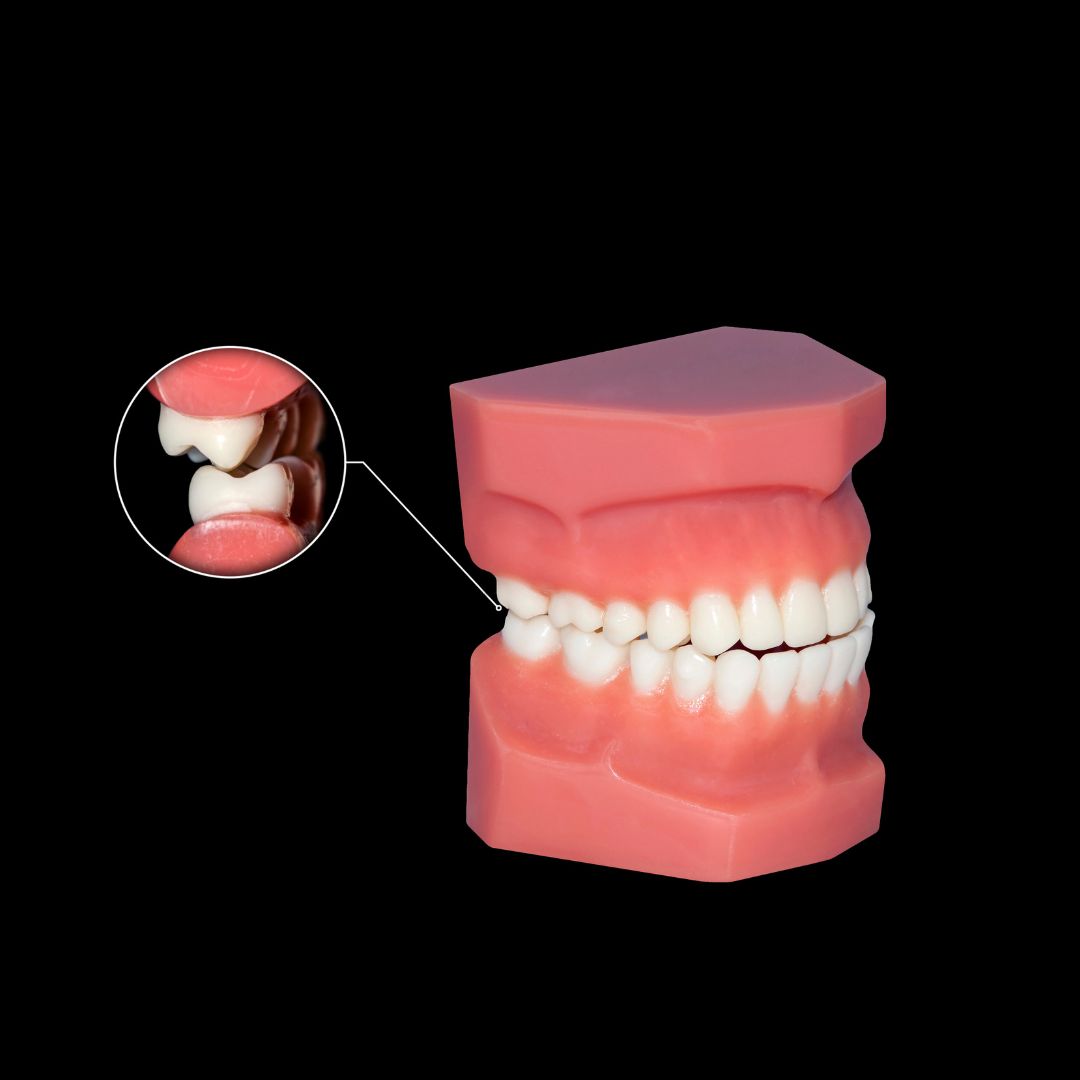 Molar Teeth Function and Care Guide