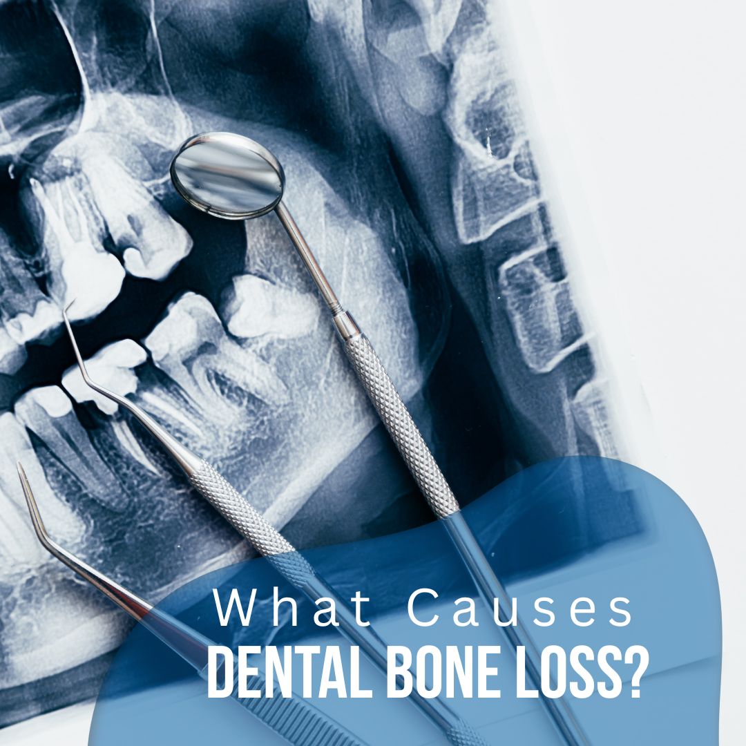 What Causes Dental Bone Loss?