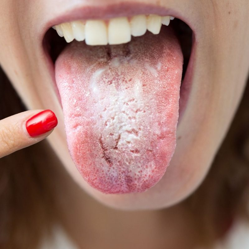 The Role of Saliva in Preventing Dental Issues