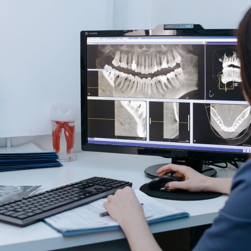 Why Routine X-Rays Are Important in Dental Care