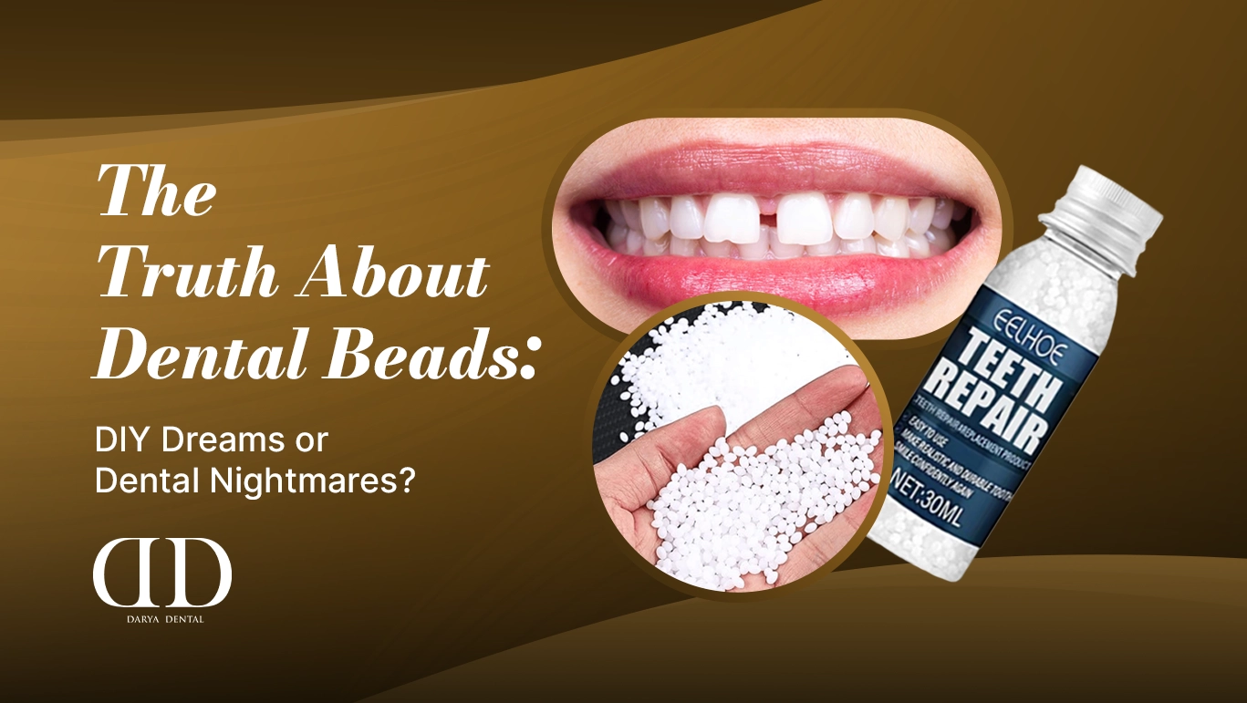 The Truth About Dental Beads: DIY Dreams or Dental Nightmares?