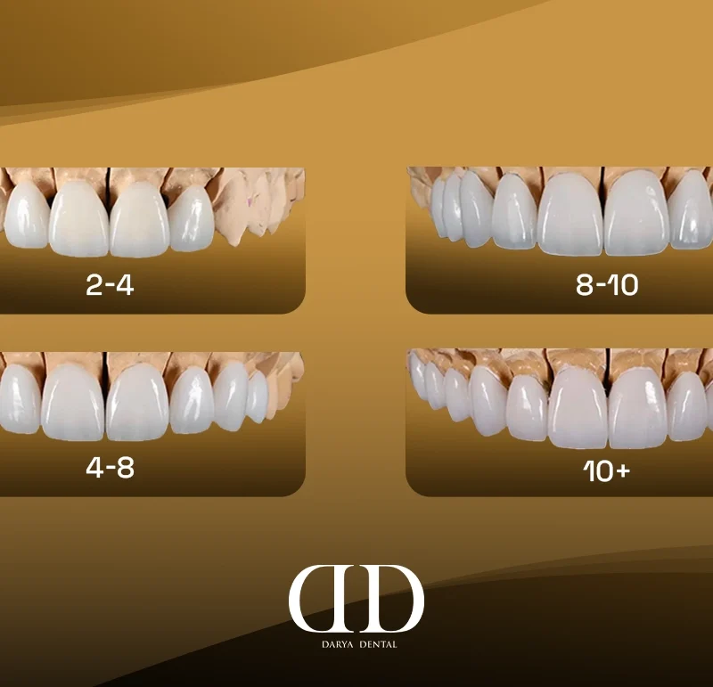 how many veneers should you get