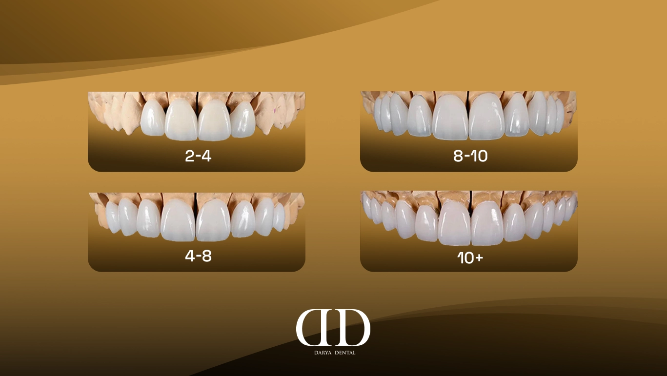 How Many Veneers Should I Get? Choosing the Right Number for Your Smile