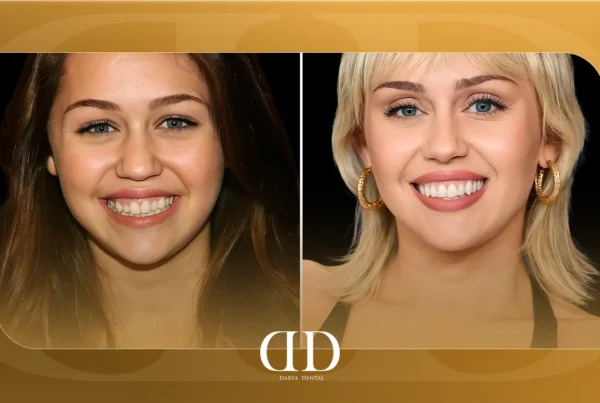 Miley Cyrus's teeth