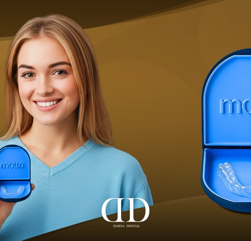 Motto clear aligners