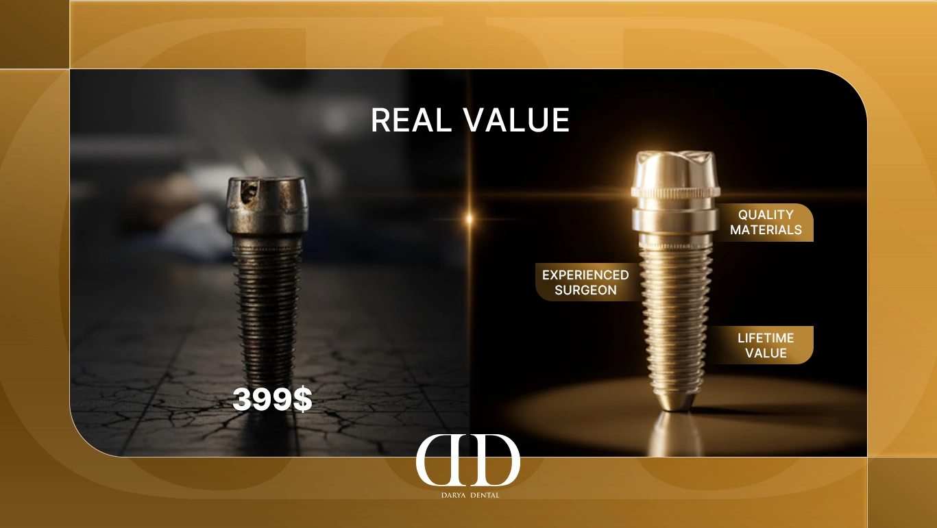 $399 Dental Implants: The Truth Behind Budget Implants and Where to Find Real Value