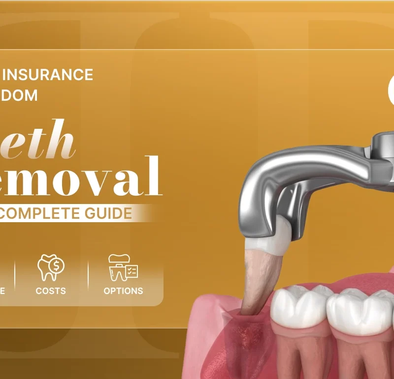 dental insurance for wisdom teeth removal
