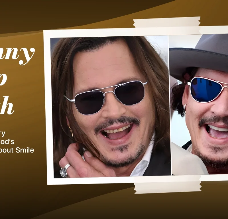 Johnny depp teeth makeover