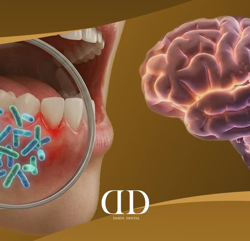 Gum disease and Alzheimer's