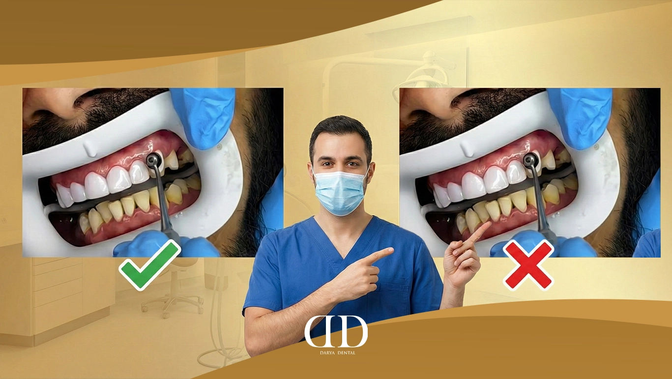 Composite Bonding: The Truth About the Controversy