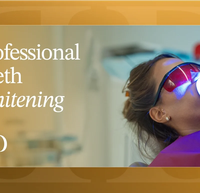 Professional teeth whitening