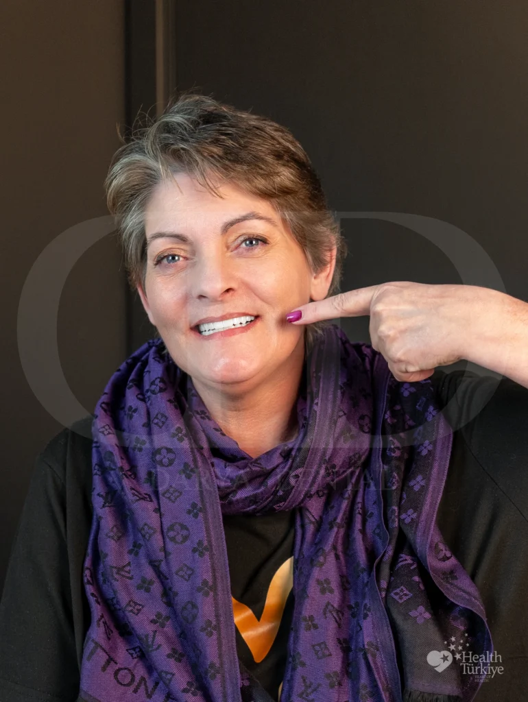 Bego implants turkey