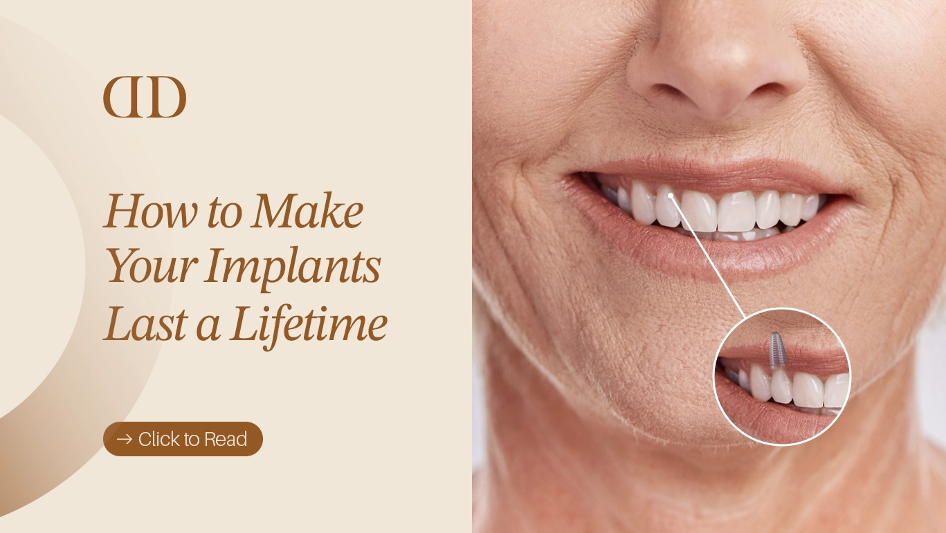 Implants after care
