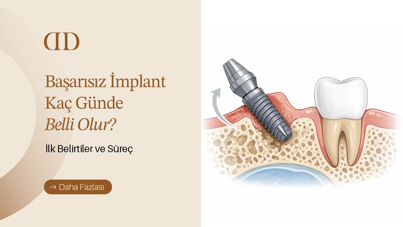 Başarısız İmplant