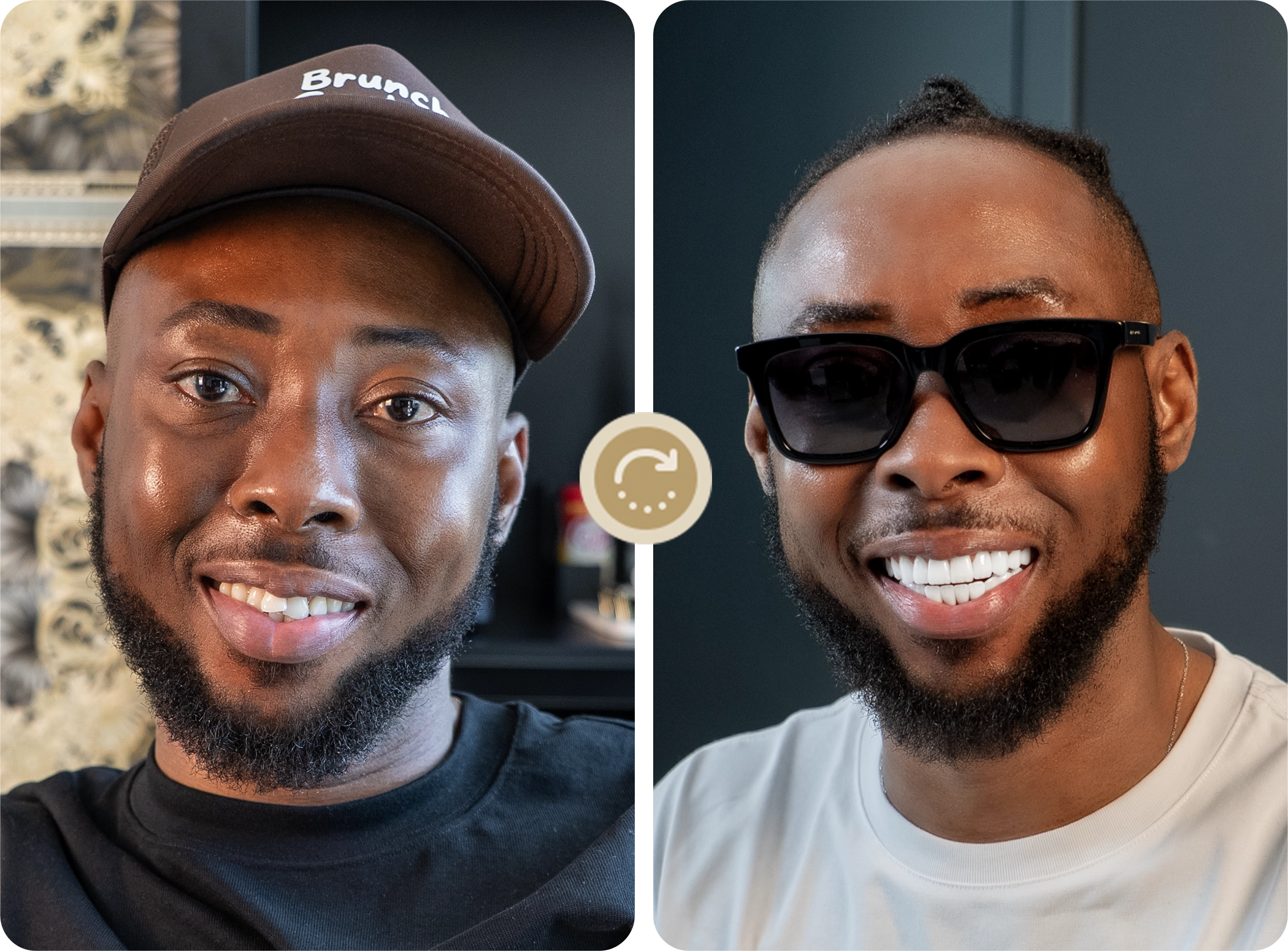 E-max crowns natural effect