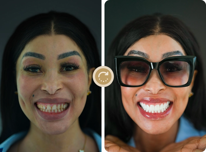 Khanyi Mbau before after