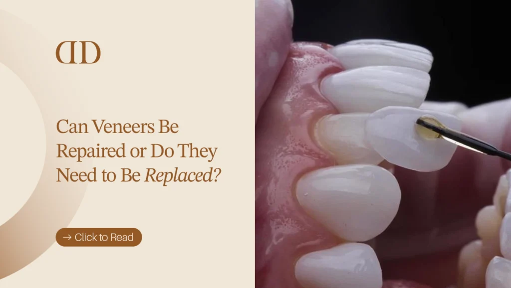 Options for repairing or replacing damaged dental veneers