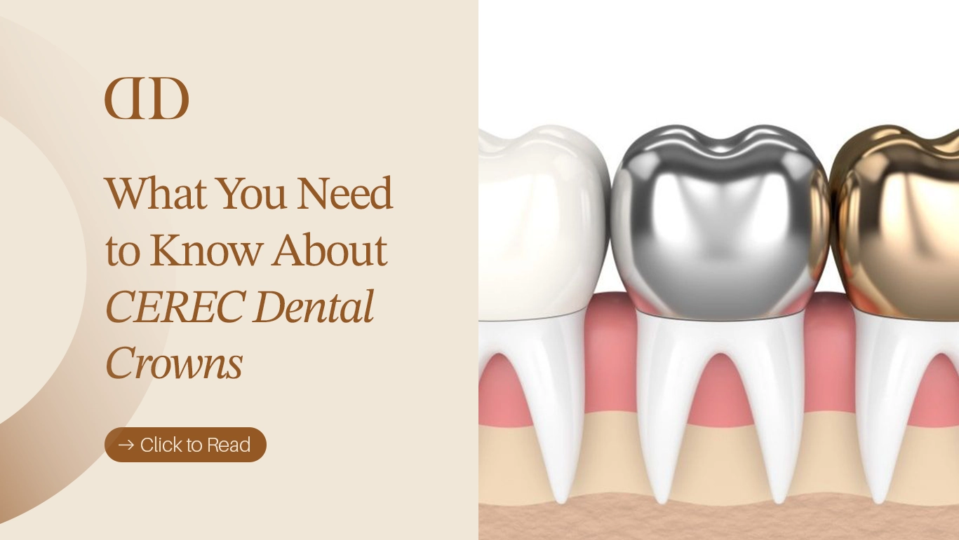cerec crowns
