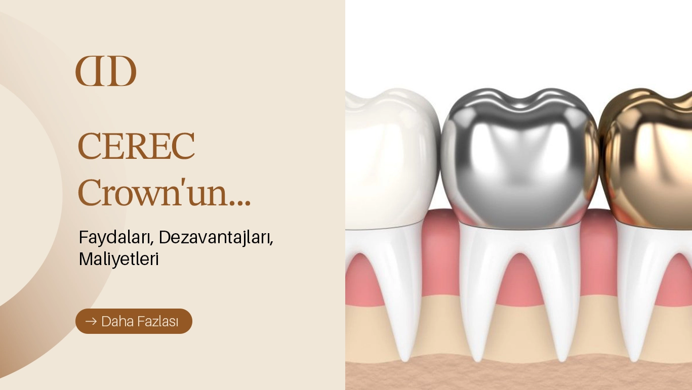Cerec Kaplama