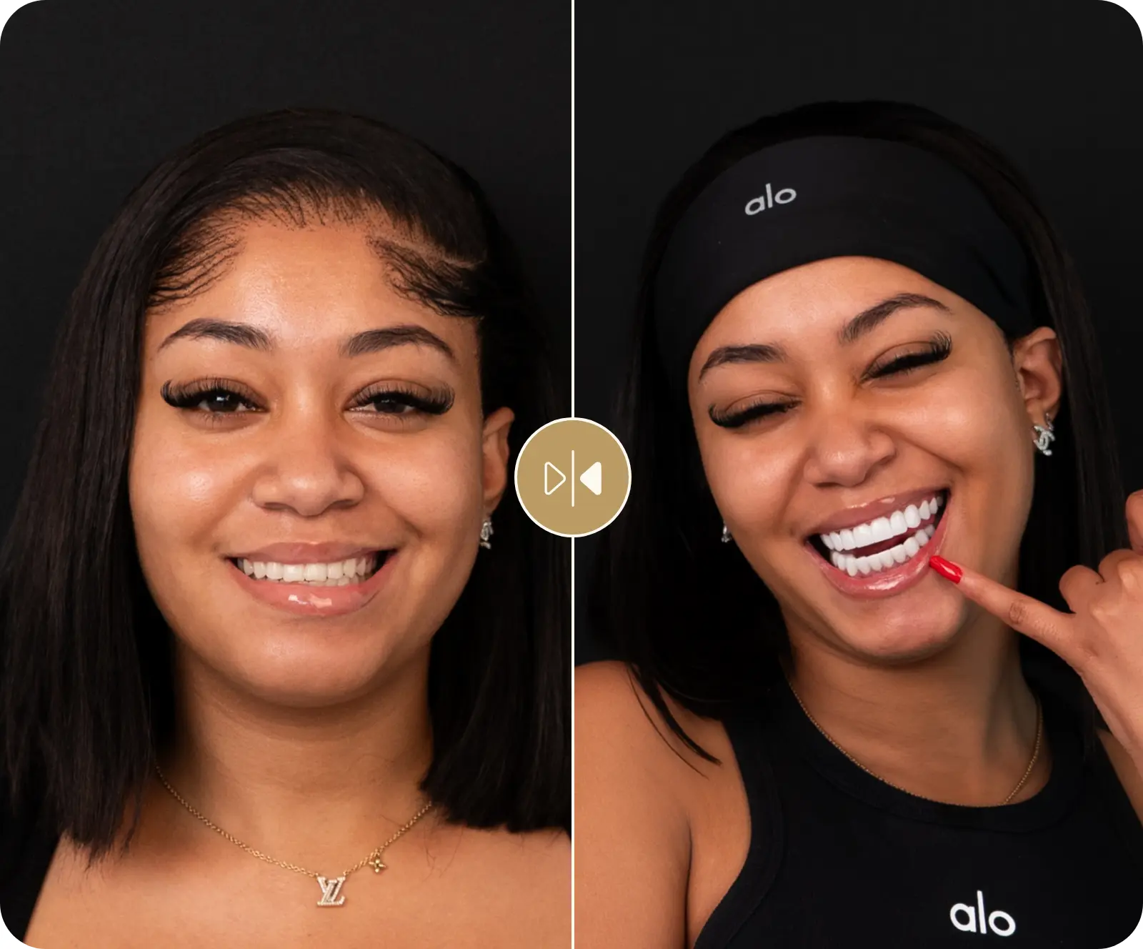 Charlene Before & After
