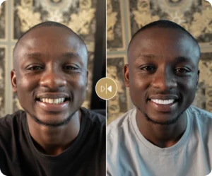 Collins Before & After