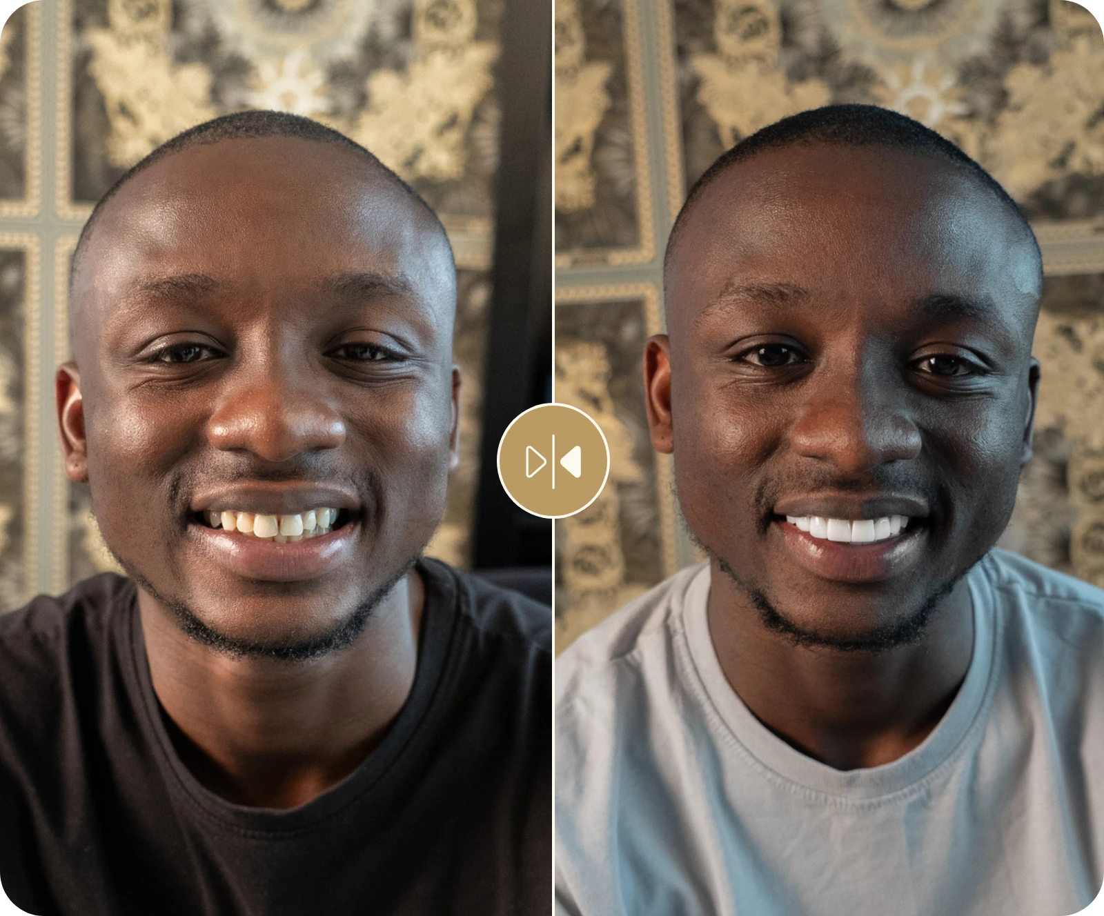 Collins Before & After