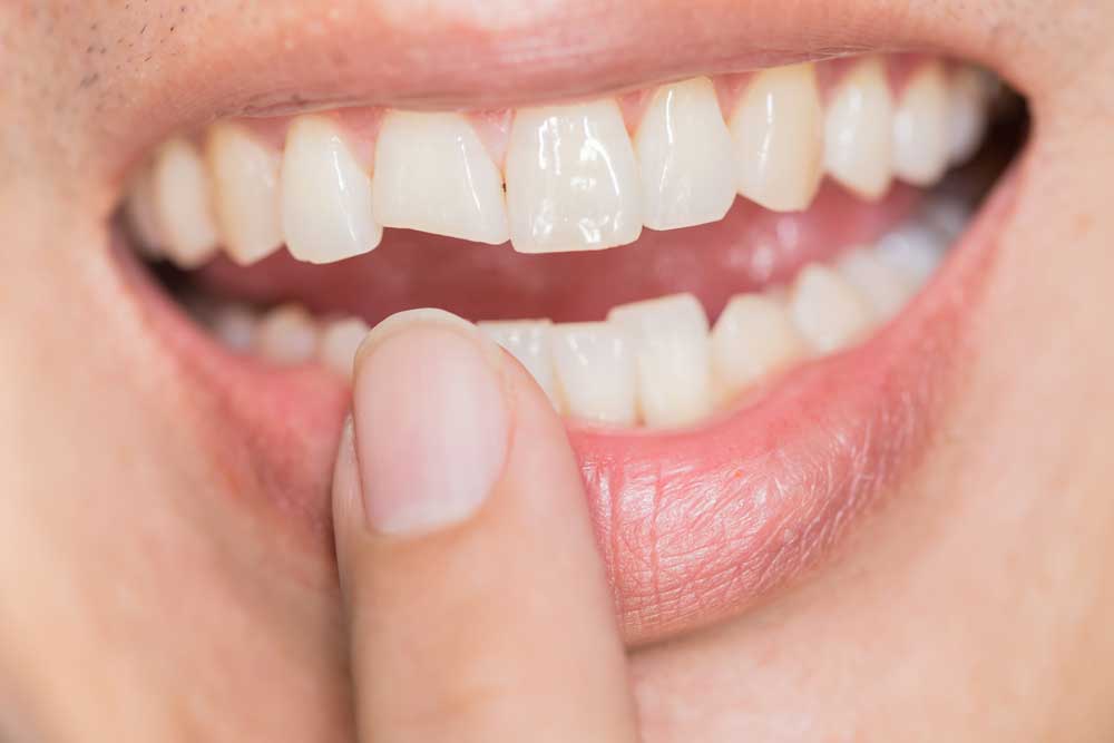 dental trauma
