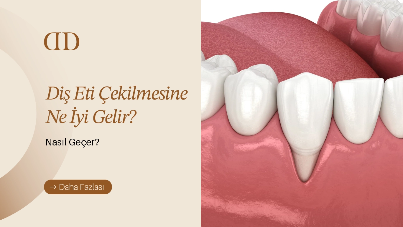 Diş eti çekilmesi ve tedavi yöntemlerini gösteren diş sağlığı görseli