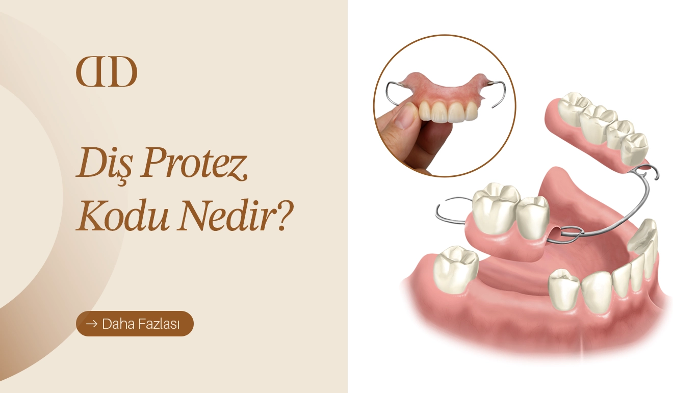Diş protez kodu nedir – protez diş tedavilerini sınıflandırmak için kullanılan dental kod sistemi