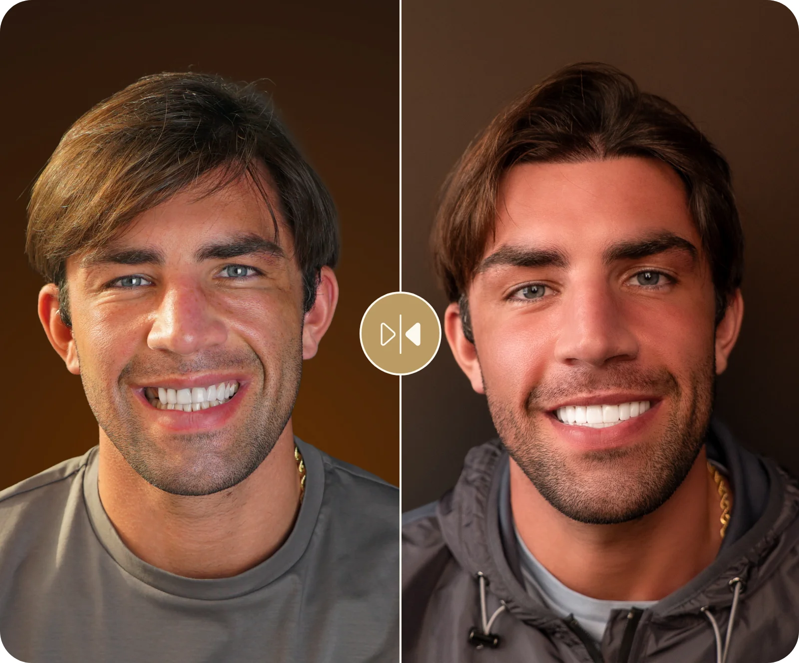 Jack Fincham Before & After